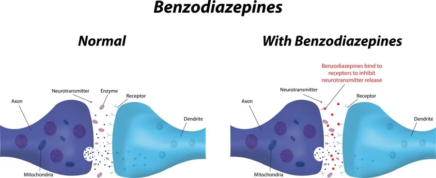 What are the Health Risks of Benzodiazepine Misuse