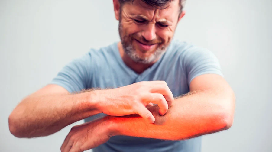 Skin Picking Disorder