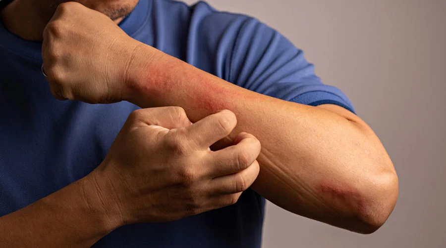 Self-Harming Behavior