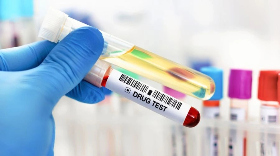 Drug and Alcohol Testing and Detection Times