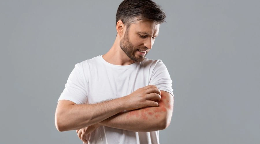 Meth Sores and Skin-Picking